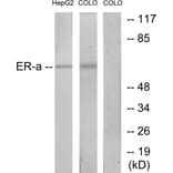 Western Blot - Anti-Estrogen Receptor-alpha Antibody (B7078) - Antibodies.com