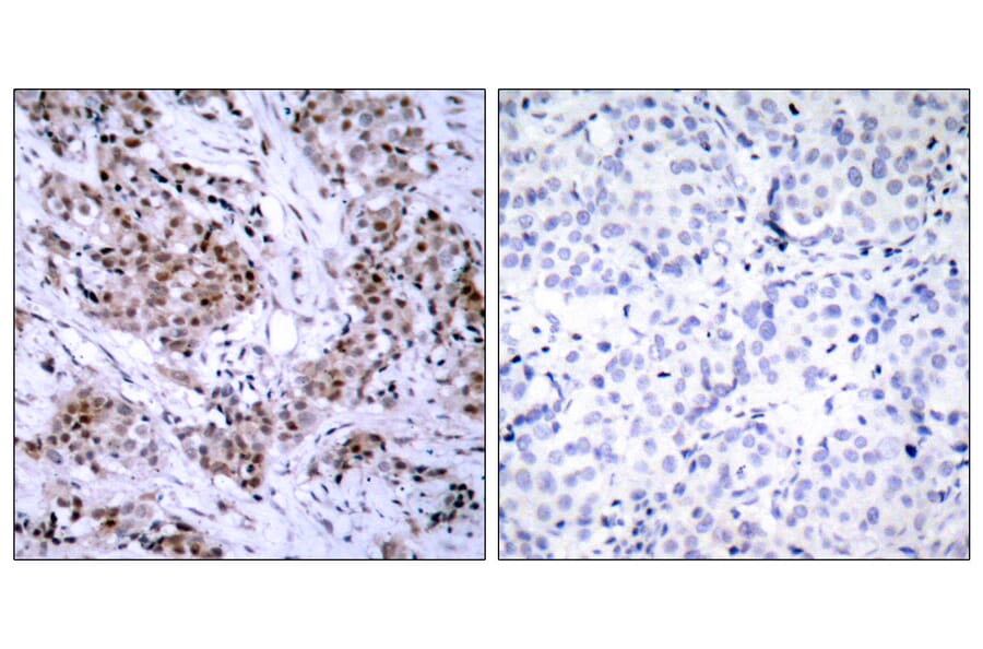 Immunohistochemistry - Anti-Estrogen Receptor-alpha Antibody (B7078) - Antibodies.com