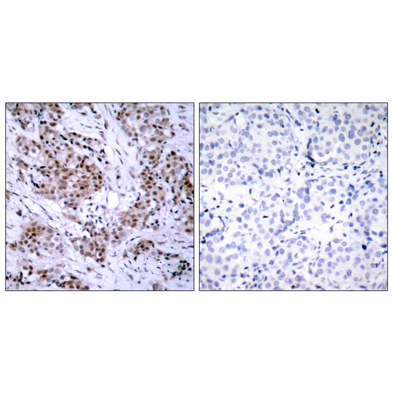 Immunohistochemistry - Anti-Estrogen Receptor-alpha Antibody (B7078) - Antibodies.com