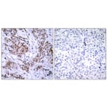 Immunohistochemistry - Anti-Estrogen Receptor-alpha Antibody (B7078) - Antibodies.com