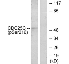 Western Blot - Anti-CDC25C (phospho Ser216) Antibody (A7038) - Antibodies.com