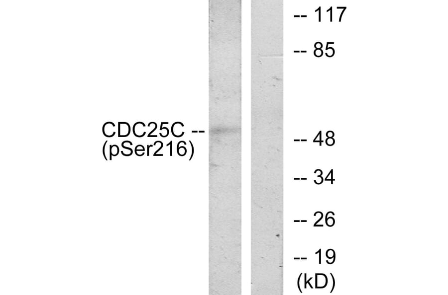 Western Blot - Anti-CDC25C (phospho Ser216) Antibody (A7038) - Antibodies.com