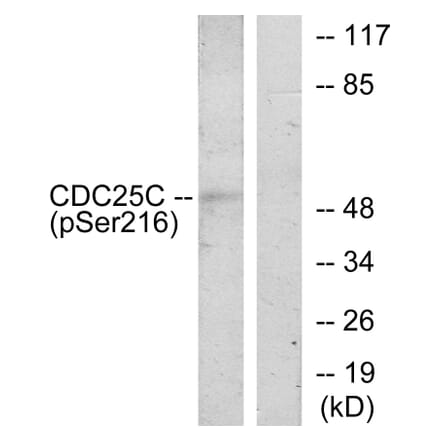 Western Blot - Anti-CDC25C (phospho Ser216) Antibody (A7038) - Antibodies.com