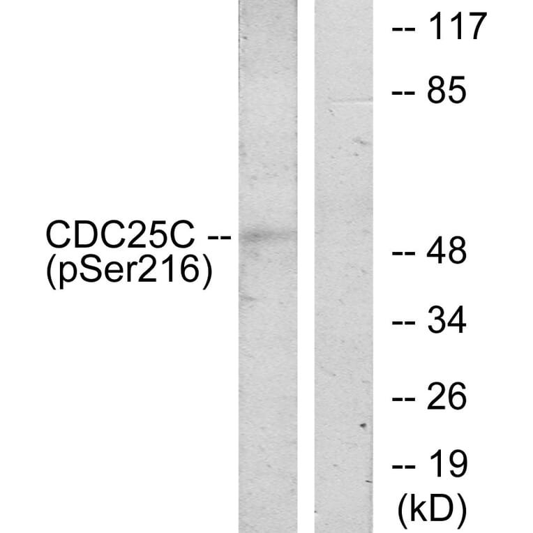 Western Blot - Anti-CDC25C (phospho Ser216) Antibody (A7038) - Antibodies.com