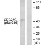 Western Blot - Anti-CDC25C (phospho Ser216) Antibody (A7038) - Antibodies.com