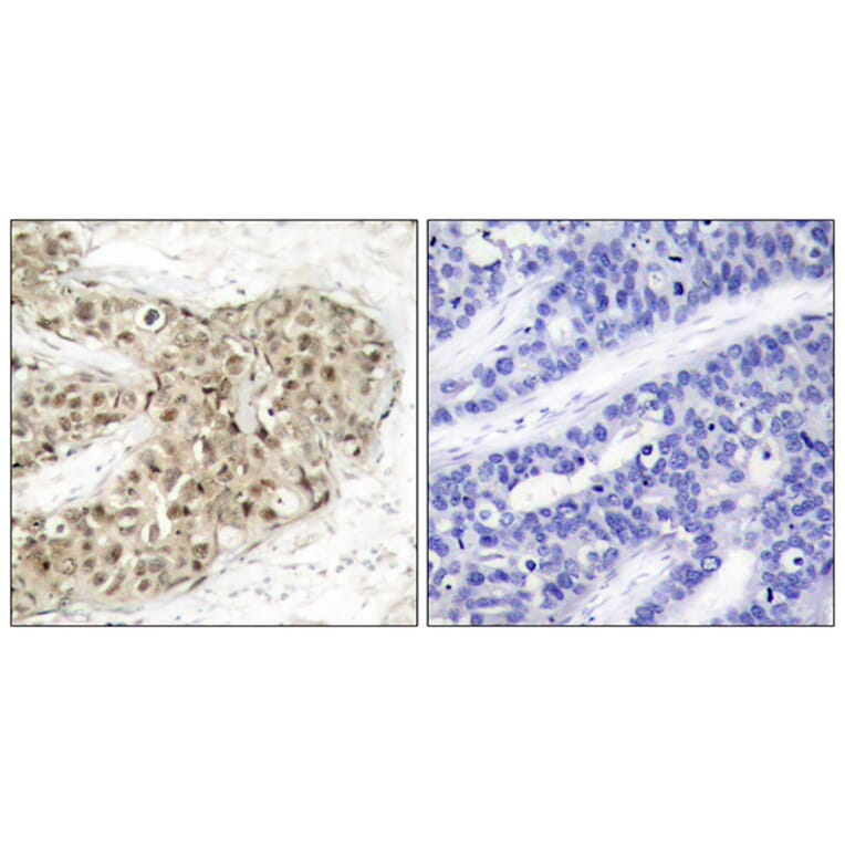 Immunohistochemistry - Anti-CDC25C (phospho Ser216) Antibody (A7038) - Antibodies.com