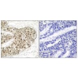 Immunohistochemistry - Anti-CDC25C (phospho Ser216) Antibody (A7038) - Antibodies.com