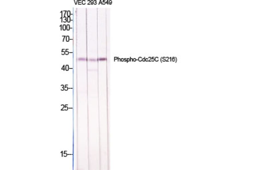 Western Blot - Anti-CDC25C (phospho Ser216) Antibody (A7038) - Antibodies.com