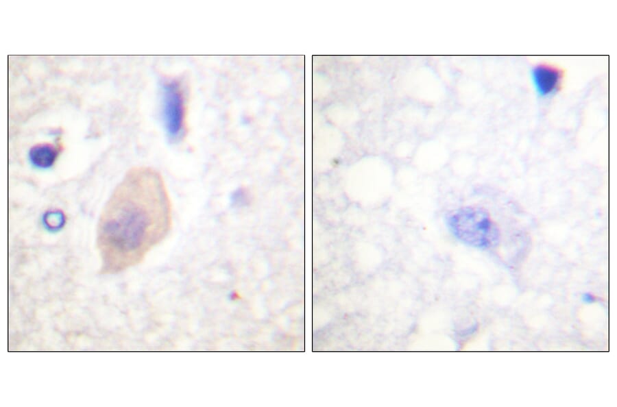 Immunohistochemistry - Anti-CDC25B (phospho Ser353) Antibody (A0855) - Antibodies.com