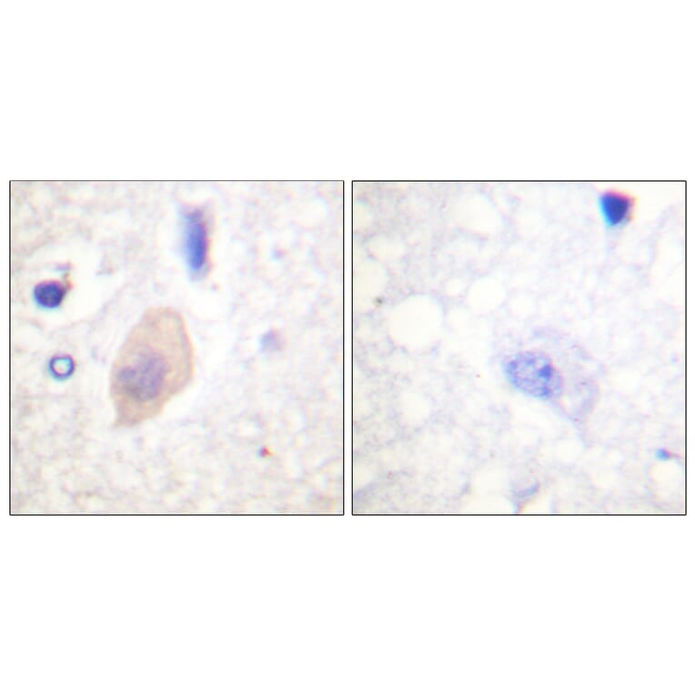 Immunohistochemistry - Anti-CDC25B (phospho Ser353) Antibody (A0855) - Antibodies.com