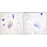 Immunohistochemistry - Anti-CDC25B (phospho Ser353) Antibody (A0855) - Antibodies.com