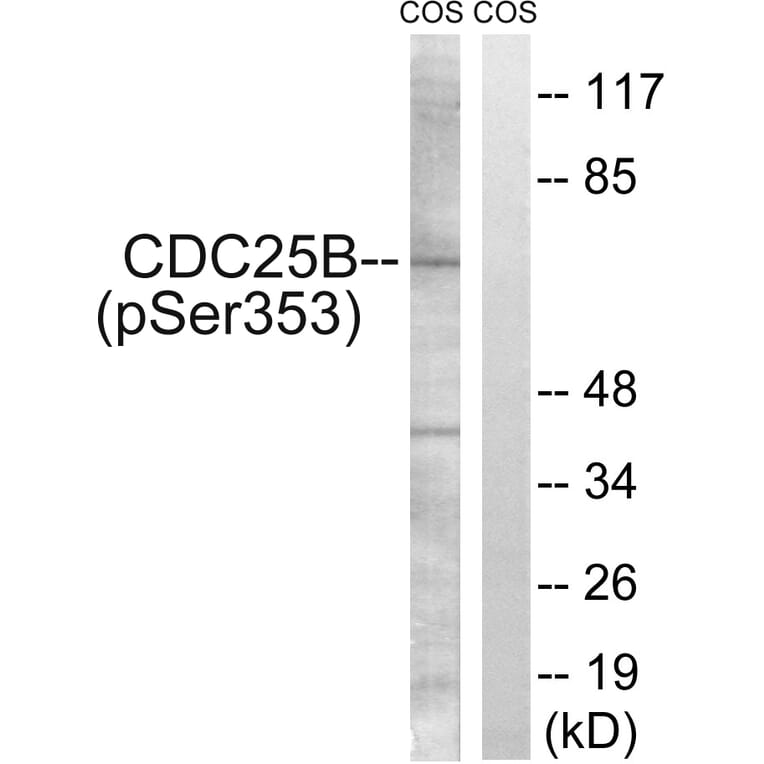 Western Blot - Anti-CDC25B (phospho Ser353) Antibody (A0855) - Antibodies.com