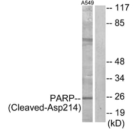 Western Blot - Anti-PARP (cleaved Asp214) Antibody (L0365) - Antibodies.com
