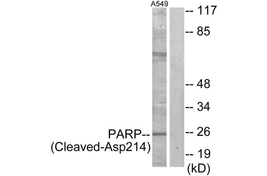 Western Blot - Anti-PARP (cleaved Asp214) Antibody (L0365) - Antibodies.com