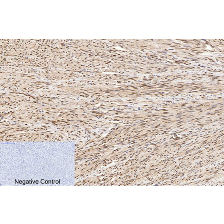 Immunohistochemistry - Anti-PARP (cleaved Asp214) Antibody (L0365) - Antibodies.com