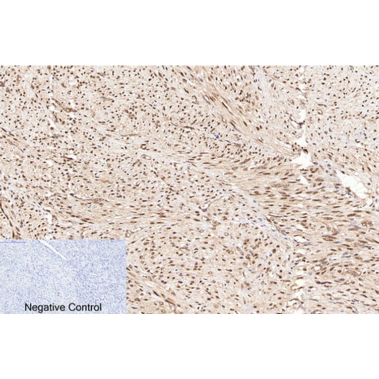 Immunohistochemistry - Anti-PARP (cleaved Asp214) Antibody (L0365) - Antibodies.com