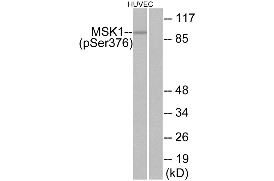 Western Blot - Anti-MSK1 (phospho Ser376) Antibody (A7155) - Antibodies.com