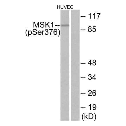 Western Blot - Anti-MSK1 (phospho Ser376) Antibody (A7155) - Antibodies.com