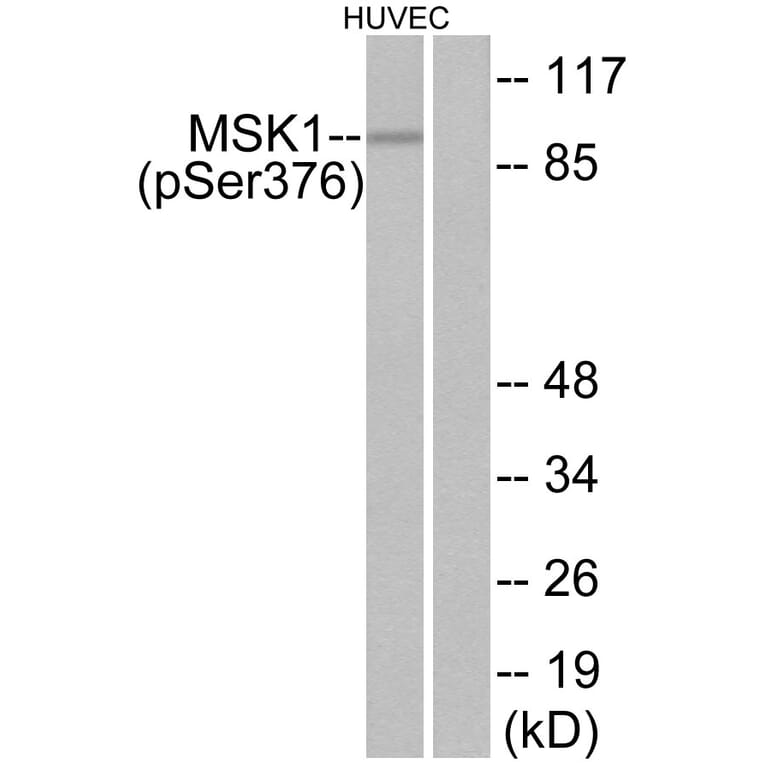 Western Blot - Anti-MSK1 (phospho Ser376) Antibody (A7155) - Antibodies.com