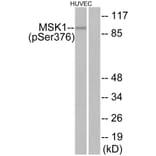 Western Blot - Anti-MSK1 (phospho Ser376) Antibody (A7155) - Antibodies.com