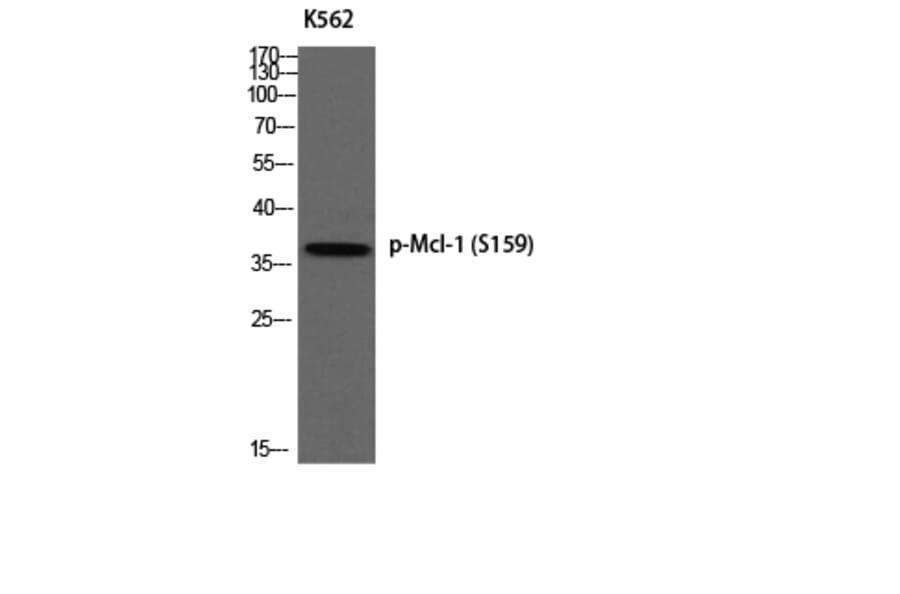 Western Blot - Anti-MCL1 (phospho Ser159) Antibody (A1097) - Antibodies.com