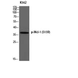 Western Blot - Anti-MCL1 (phospho Ser159) Antibody (A1097) - Antibodies.com