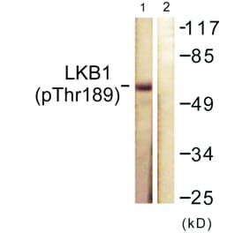 Western Blot - Anti-LKB1 (phospho Thr189) Antibody (A0673) - Antibodies.com