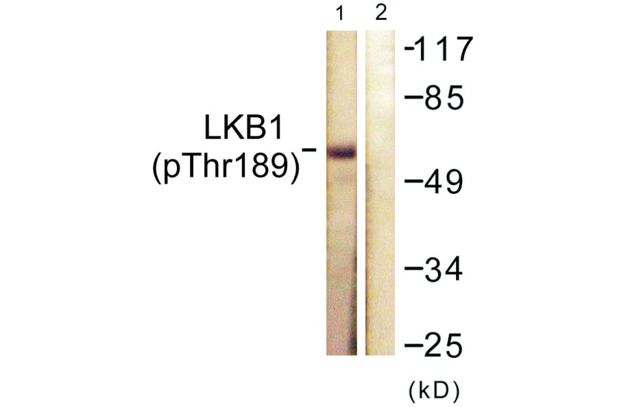 Western Blot - Anti-LKB1 (phospho Thr189) Antibody (A0673) - Antibodies.com