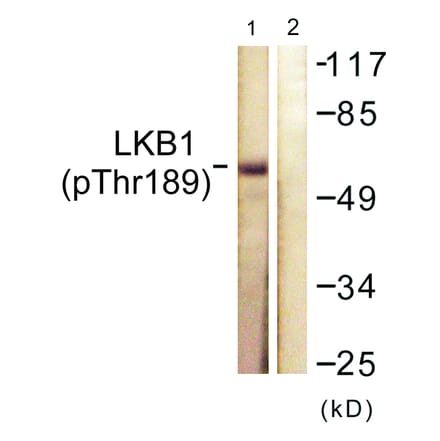 Western Blot - Anti-LKB1 (phospho Thr189) Antibody (A0673) - Antibodies.com