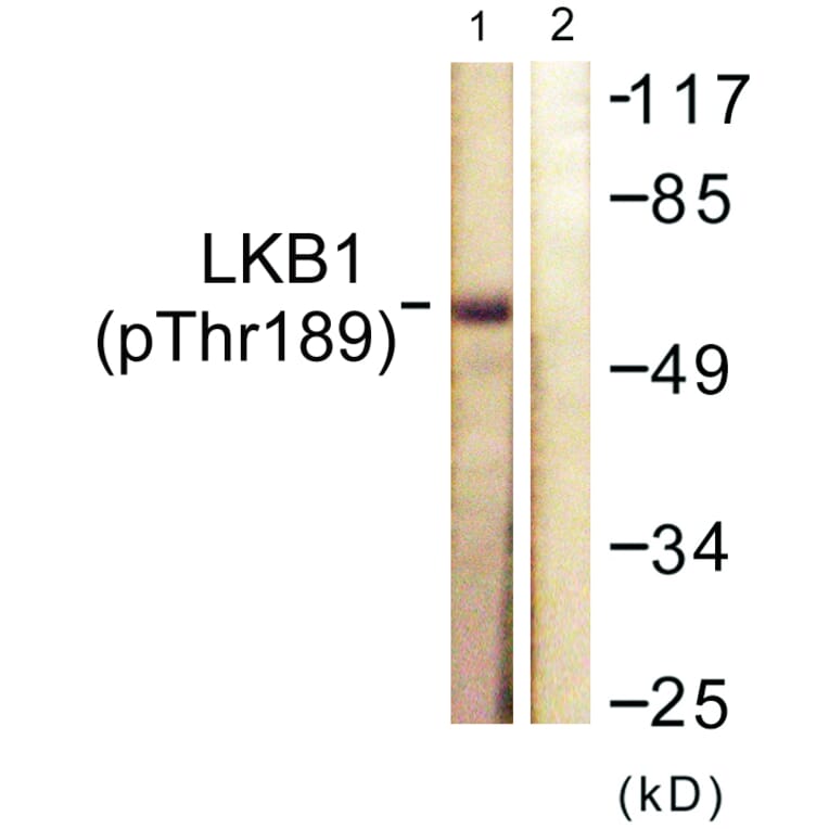 Western Blot - Anti-LKB1 (phospho Thr189) Antibody (A0673) - Antibodies.com
