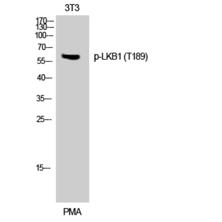 Western Blot - Anti-LKB1 (phospho Thr189) Antibody (A0673) - Antibodies.com