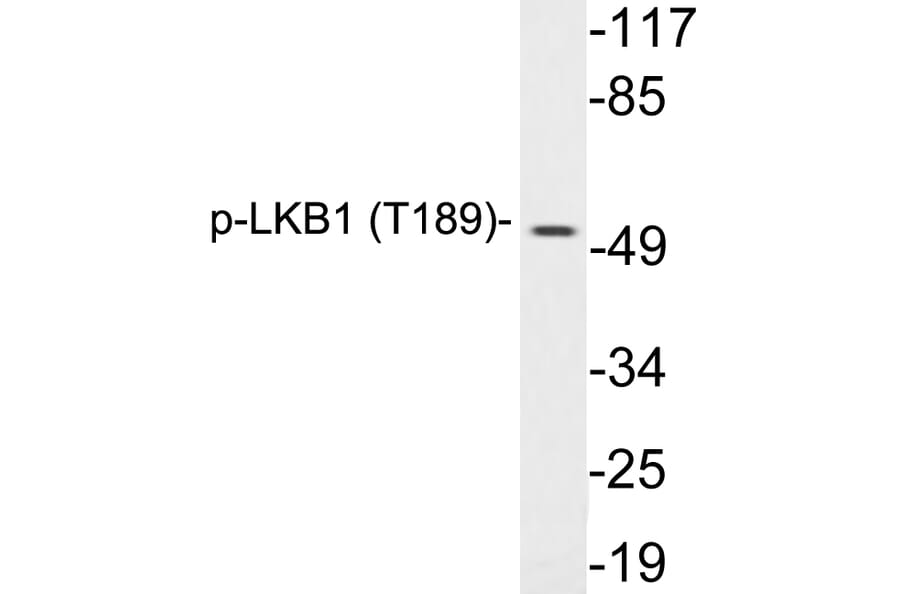 Western Blot - Anti-LKB1 (phospho Thr189) Antibody (P12-1033) - Antibodies.com