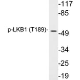 Western Blot - Anti-LKB1 (phospho Thr189) Antibody (P12-1033) - Antibodies.com