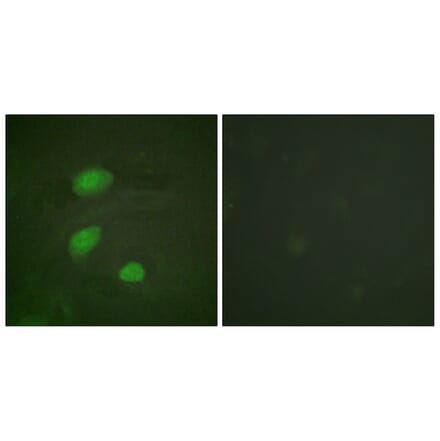 Immunofluorescence - Anti-HIRA (phospho Thr555) Antibody (A1037) - Antibodies.com