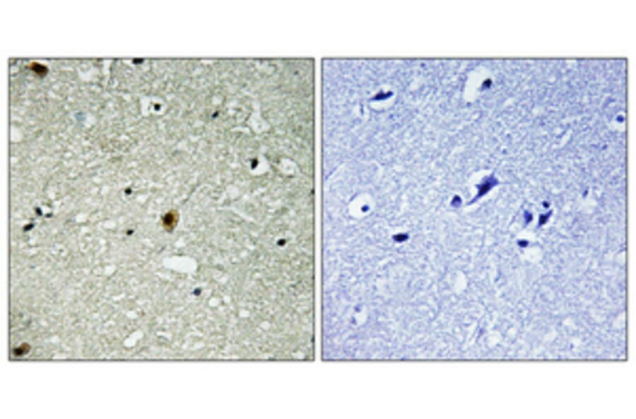 Immunohistochemistry - Anti-HIRA (phospho Thr555) Antibody (A1037) - Antibodies.com