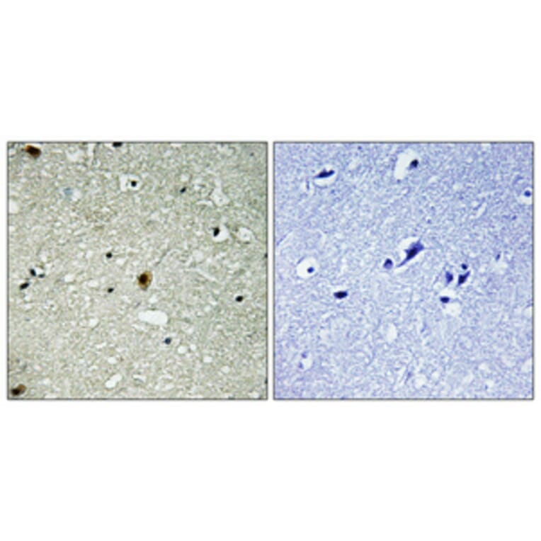 Immunohistochemistry - Anti-HIRA (phospho Thr555) Antibody (A1037) - Antibodies.com