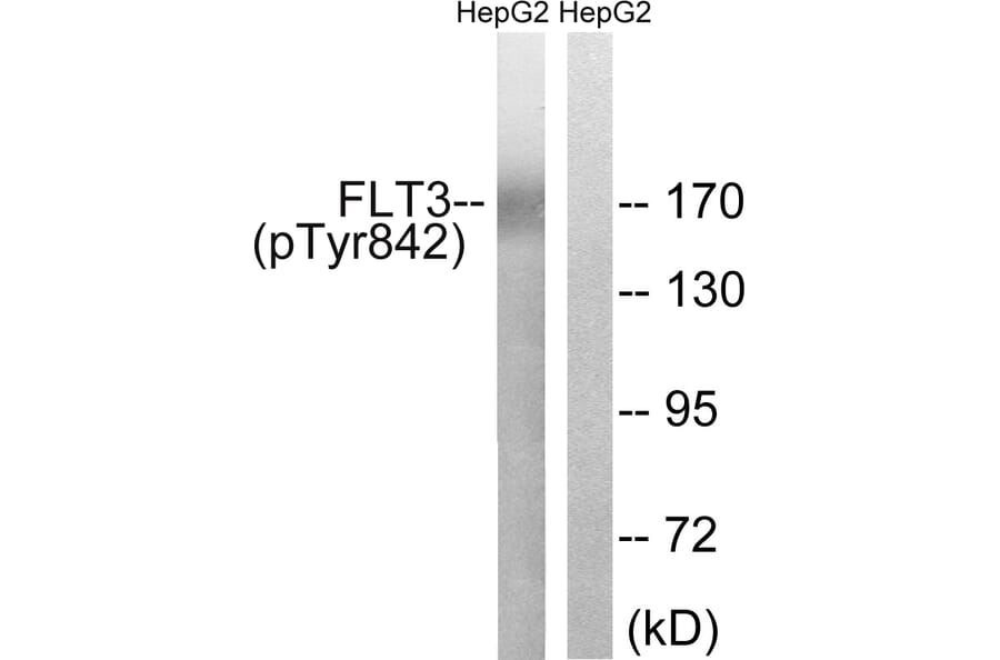 Western Blot - Anti-FLT3 (phospho Tyr842) Antibody (A8107) - Antibodies.com