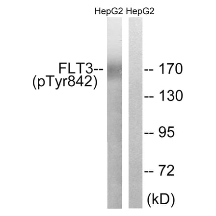Western Blot - Anti-FLT3 (phospho Tyr842) Antibody (A8107) - Antibodies.com