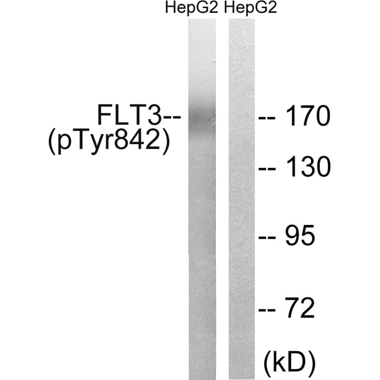 Western Blot - Anti-FLT3 (phospho Tyr842) Antibody (A8107) - Antibodies.com