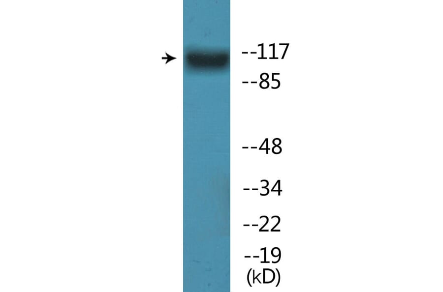 Western Blot - Anti-FLT3 (phospho Tyr842) Antibody (P12-1107) - Antibodies.com