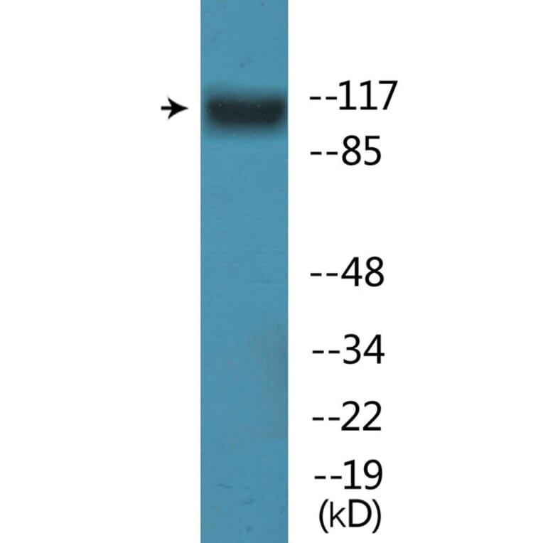 Western Blot - Anti-FLT3 (phospho Tyr842) Antibody (P12-1107) - Antibodies.com