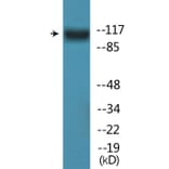 Western Blot - Anti-FLT3 (phospho Tyr842) Antibody (P12-1107) - Antibodies.com