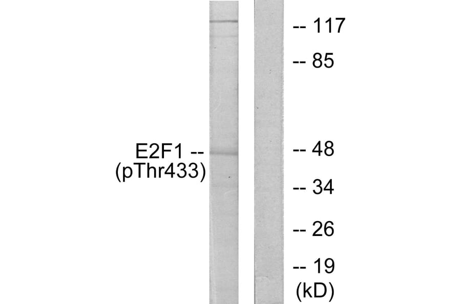 Western Blot - Anti-E2F1 (phospho Thr433) Antibody (A0423) - Antibodies.com