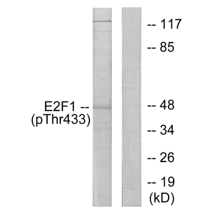 Western Blot - Anti-E2F1 (phospho Thr433) Antibody (A0423) - Antibodies.com