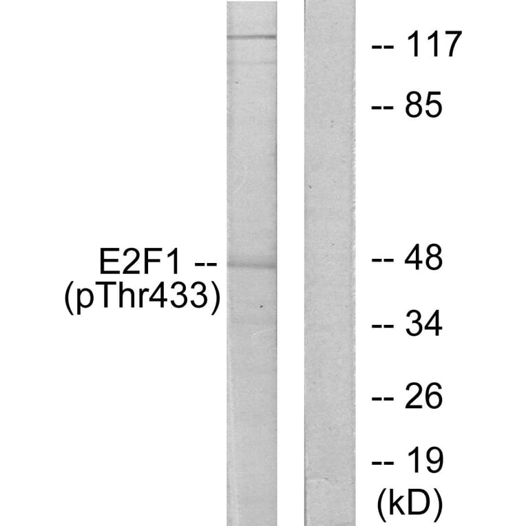 Western Blot - Anti-E2F1 (phospho Thr433) Antibody (A0423) - Antibodies.com