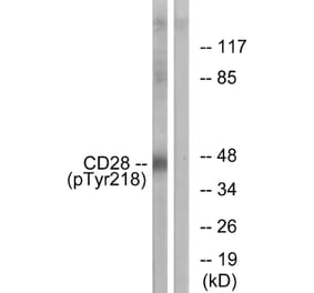 Western Blot - Anti-CD28 (phospho Tyr218) Antibody (A0845) - Antibodies.com