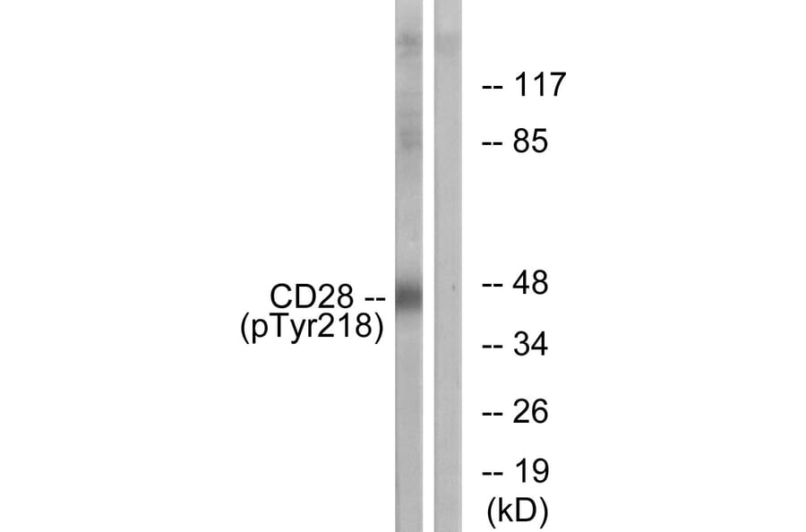 Western Blot - Anti-CD28 (phospho Tyr218) Antibody (A0845) - Antibodies.com