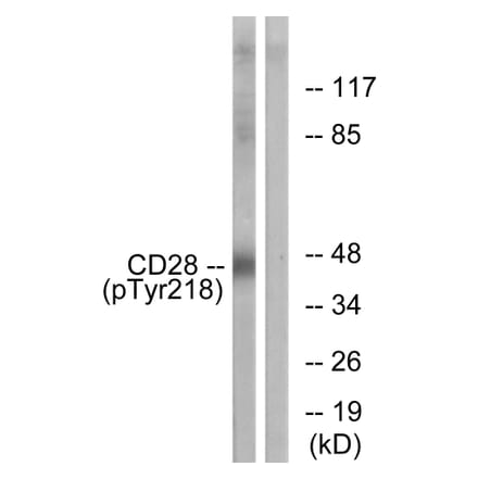 Western Blot - Anti-CD28 (phospho Tyr218) Antibody (A0845) - Antibodies.com