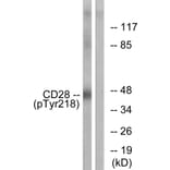 Western Blot - Anti-CD28 (phospho Tyr218) Antibody (A0845) - Antibodies.com