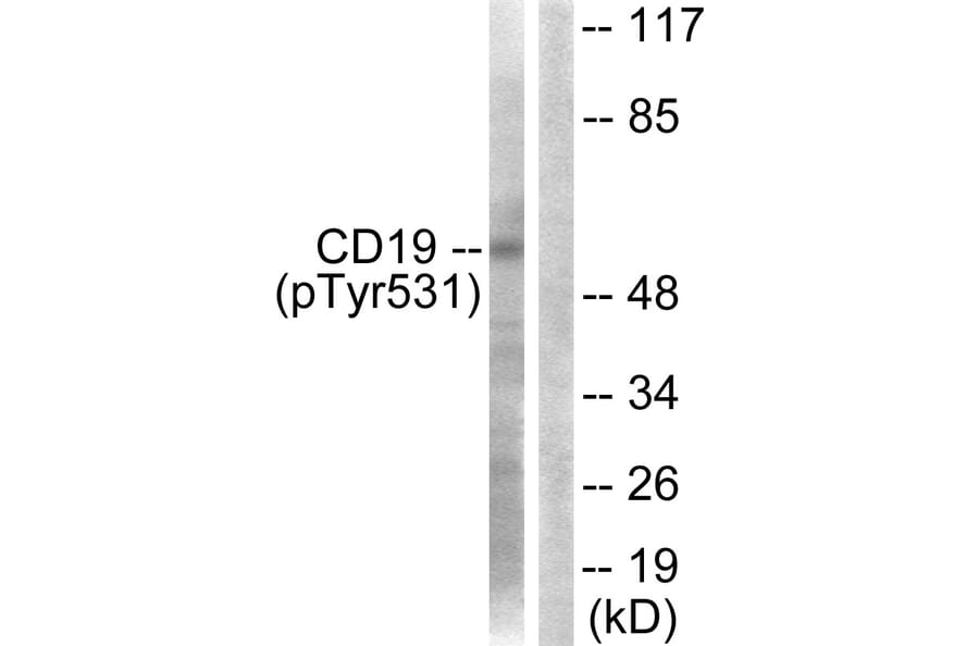 Western Blot - Anti-CD19 (phospho Tyr531) Antibody (A0412) - Antibodies.com